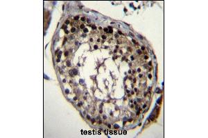 DAZ4 Antibody (Center) (ABIN656487 and ABIN2845764) immunohistochemistry analysis in formalin fixed and paraffin embedded human testis tissue followed by peroxidase conjugation of the secondary antibody and DAB staining. (DAZ4 antibody  (AA 90-119))