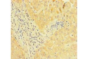 Immunohistochemistry of paraffin-embedded human liver tissue using ABIN7164549 at dilution of 1:100 (JMJD1C antibody  (AA 539-648))