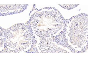 Detection of CHRDL1 in Mouse Testis Tissue using Polyclonal Antibody to Chordin Like Protein 1 (CHRDL1) (CHRDL1 antibody  (AA 272-447))