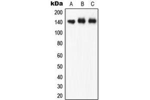 Western blot analysis of eNOS (pS1177) expression in A549 (A), HuvEc (B), rat brain (C) whole cell lysates. (ENOS antibody  (C-Term, pSer1177))