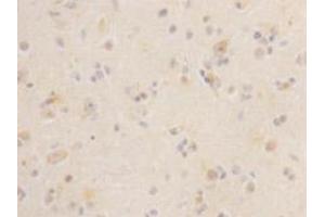 Immunohistochemistry (Paraffin-embedded Sections) (IHC (p)) image for anti-Leucine-Rich Repeat Containing G Protein-Coupled Receptor 5 (LGR5) antibody (ABIN1112906) (LGR5 antibody)