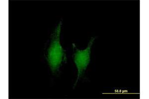 Immunofluorescence of purified MaxPab antibody to TRAF5 on HeLa cell. (TRAF5 antibody  (AA 1-557))