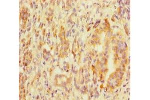 Immunohistochemistry of paraffin-embedded human pancreatic tissue using ABIN7159120 at dilution of 1:100 (MED29 antibody  (AA 1-212))