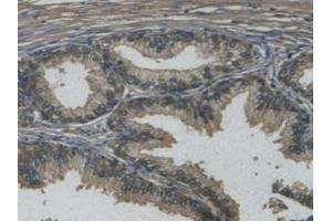 IHC-P analysis of Human Prostate Gland Tissue, with DAB staining. (REG3g antibody  (AA 39-175))