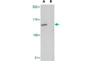 Western blot analysis of GP6 in A-20 lysate with GP6 polyclonal antibody  at 1 ug/m in either the absence or (B) the presence of blocking peptide.