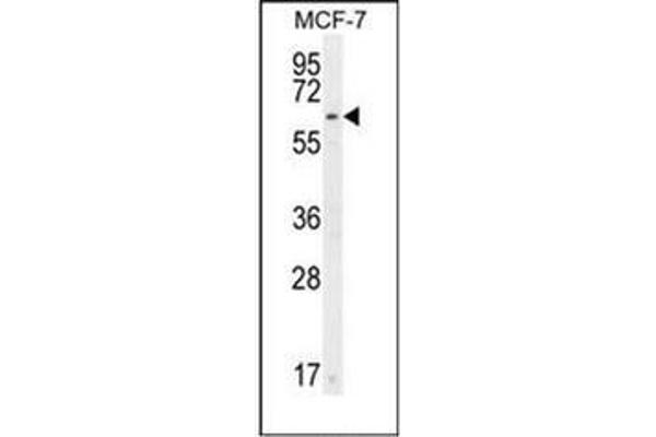 CTDSPL2 antibody  (N-Term)