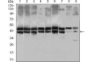 Western blot analysis using IL2RA mouse mAb against Hela (1), MOLT4 (2), HEK293 (3), A549 (4), Jurkat (5), K562 (6), Cos7 (7), PC-12 (8) and NIH/3T3 (9) cell lysate. (CD25 antibody  (AA 34-139))