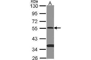 WB Image Sample (30 ug of whole cell lysate) A: NT2D1 10% SDS PAGE antibody diluted at 1:500 (SMAD9 antibody)