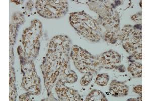 Immunoperoxidase of monoclonal antibody to CNAP1 on formalin-fixed paraffin-embedded human placenta. (NCAPD2 antibody  (AA 1240-1339))