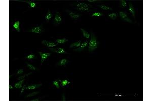 Immunofluorescence of monoclonal antibody to ZSCAN18 on HeLa cell. (ZSCAN18 antibody  (AA 1-510))