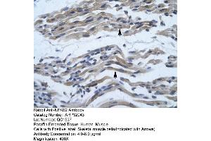 Human Muscle (NFKB2 antibody  (C-Term))