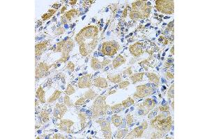 Immunohistochemistry of paraffin-embedded human stomach using BCR antibody at dilution of 1:100 (x40 lens). (BCR antibody)