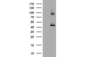 Image no. 1 for anti-Melanoma Antigen Family A, 3 (MAGEA3) antibody (ABIN1499258) (MAGEA3 antibody)