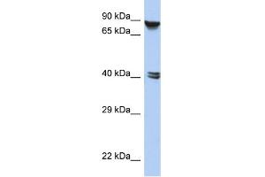 WB Suggested Anti-ZNF429 Antibody Titration:  0. (ZNF429 antibody  (N-Term))