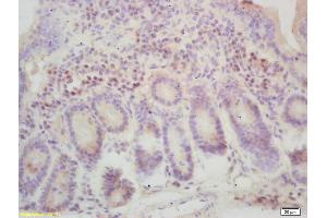 Formalin-fixed and paraffin embedded mouse intestine labeled with Rabbit Anti Dmt1 Polyclonal Antibody, Unconjugated (ABIN1713486) at 1:200 followed by conjugation to the secondary antibody and DAB staining (SLC11A2 antibody  (AA 4-50))