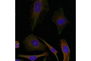 Immunofluorescence staining of methanol-fixed Hela cells using GAP43(Ab-41) Antibody.