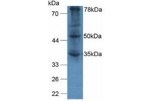 Detection of vWA2 in Human A375 Cells using Polyclonal Antibody to Von Willebrand Factor A Domain Containing Protein 2 (vWA2) (VWA2 antibody  (AA 457-708))