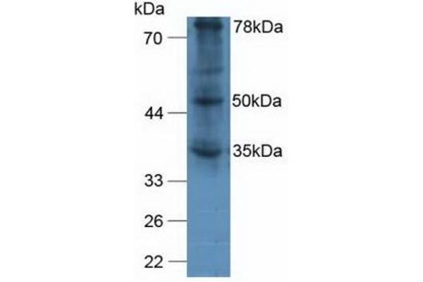 VWA2 anticorps  (AA 457-708)