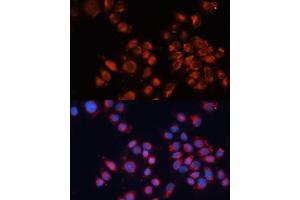 Immunofluorescence analysis of HeLa cells using Cation-independent M6PR (Cation-independent M6PR (IGF2R)) antibody (ABIN6130063, ABIN6142247, ABIN6142248 and ABIN6216853) at dilution of 1:100. (IGF2R antibody  (AA 2327-2491))