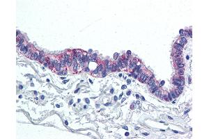 Anti-IL-6 antibody IHC of human lung, respiratory epithelium. (IL-6 antibody  (Internal Region))
