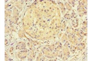 Immunohistochemistry of paraffin-embedded human pancreatic tissue using ABIN7172144 at dilution of 1:100 (THADA antibody  (AA 432-651))