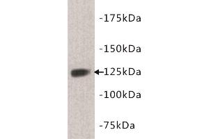 Western Blotting (WB) image for anti-tyrosine Kinase with Immunoglobulin-Like and EGF-Like Domains 1 (TIE1) (N-Term) antibody (ABIN1854998) (TIE1 antibody  (N-Term))