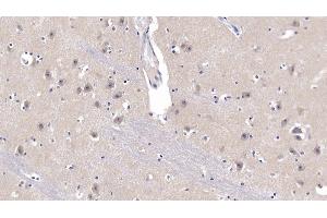 Detection of APP in Human Cerebrum Tissue using Polyclonal Antibody to Amyloid Precursor Protein (APP) (APP antibody  (AA 672-711))