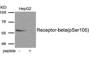 Western blot analysis of extracts from HepG2 tissue using Estrogen Receptor- beta (Phospho-Ser105) antibody. (ESR2 antibody  (pSer105))