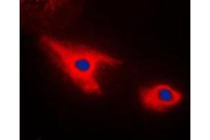 Immunofluorescent analysis of Septin 7 staining in HepG2 cells. (Septin 7 antibody  (C-Term))