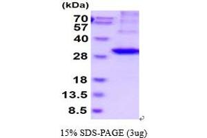 Kallikrein 2 Protein (KLK2) (AA 25-261) (His tag)