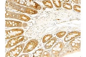 ABIN6257471 and ABIN6274750 at 1/100 staining Rat colorectal tissue by IHC-P. (RPS18 antibody  (C-Term))