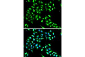 Immunofluorescence analysis of A549 cell using KIAA1456 antibody. (KIAA1456 antibody)