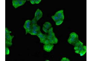 Immunofluorescent analysis of PC-3 cells using ABIN7163021 at dilution of 1:100 and Alexa Fluor 488-congugated AffiniPure Goat Anti-Rabbit IgG(H+L) (PES1 antibody  (AA 378-588))