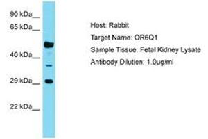 Image no. 1 for anti-Olfactory Receptor, Family 6, Subfamily Q, Member 1 (OR6Q1) (C-Term) antibody (ABIN6750774) (OR6Q1 antibody  (C-Term))