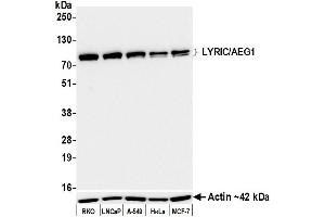 Western Blotting (WB) image for anti-Metadherin (MTDH) (AA 475-525) antibody (ABIN7795652)