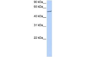 WB Suggested Anti-FBXW11 Antibody Titration:  0.