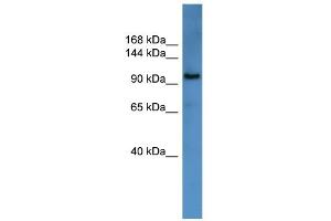 WB Suggested Anti-ZEB1 Antibody Titration:  0. (ZEB1 antibody  (N-Term))