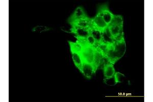 Immunofluorescence of monoclonal antibody to SYT4 on A-431 cell. (SYT4 antibody  (AA 1-99))