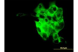 Immunofluorescence of monoclonal antibody to SYT4 on A-431 cell.
