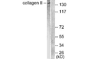 Western blot analysis of extracts from COLO205 cells, using Collagen II antibody (#C0155).
