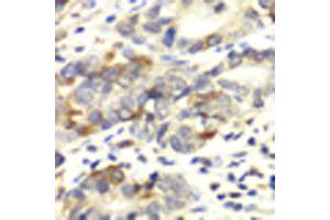 Immunohistochemistry of paraffin-embedded human colon carcinoma using APLP1 antibody at dilution of 1:100 (x40 lens). (APLP1 antibody)