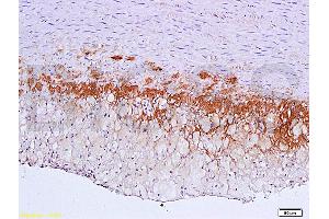 Formalin-fixed and paraffin embedded: rabbit carotid artery labeled with Anti-TGF-beta-R2/TGFBR2 Polyclonal Antibody (ABIN725225), Unconjugated 1:600 followed by conjugation to the secondary antibody and DAB staining (TGFBR2 antibody  (AA 241-330))