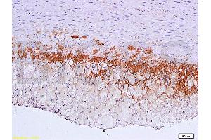 Formalin-fixed and paraffin embedded: rabbit carotid artery labeled with Anti-TGF-beta-R2/TGFBR2 Polyclonal Antibody (ABIN725225), Unconjugated 1:600 followed by conjugation to the secondary antibody and DAB staining (TGFBR2 antibody  (AA 241-330))