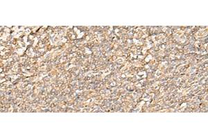 Immunohistochemistry of paraffin-embedded Human tonsil tissue using EIF3C Polyclonal Antibody at dilution of 1:35(x200) (EIF3C antibody)
