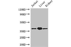 Western Blot Positive WB detected in: Jurkat whole cell lysate, Mouse liver tissue, Mouse kidney tissue All lanes: PINX1 antibody at 3. (PINX1 antibody  (AA 151-299))