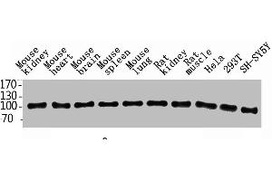 Western Blot analysis of rat-kidney hela 293T SH-SY5Y MOUSE-KIDNEY MOUSE-SPLEEN MOUSE-LUNG using ENPP3 Polyclonal Antibody. (ENPP3 antibody  (Internal Region))