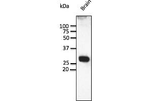 Western Blotting (WB) image for anti-RAB3A, Member RAS Oncogene Family (RAB3A) (C-Term) antibody (ABIN7272977) (RAB3A antibody  (C-Term))