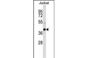 KCTD10 Antibody (C-term) (ABIN657313 and ABIN2846392) western blot analysis in Jurkat cell line lysates (35 μg/lane). (KCTD10 antibody  (C-Term))