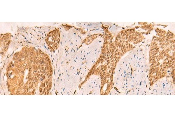 SETD1A antibody