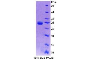 SDS-PAGE (SDS) image for Branched Chain Amino-Acid Transaminase 2, Mitochondrial (BCAT2) (AA 218-393) protein (His tag) (ABIN4990077) (BCAT2 Protein (AA 218-393) (His tag))